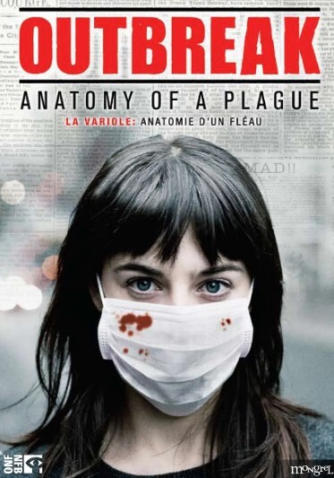 天花大爆发:瘟疫的解剖学